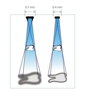 Progeny Preva DC Intraoral X-Ray